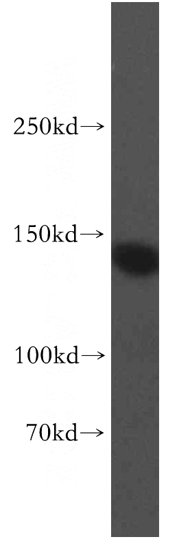mouse brain tissue were subjected to SDS PAGE followed by western blot with Catalog No:115587(SRGAP3 antibody) at dilution of 1:300