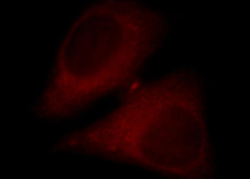 Immunofluorescent analysis of HepG2 cells, using DGKK antibody Catalog No:109913 at 1:25 dilution and Rhodamine-labeled goat anti-rabbit IgG (red).