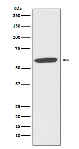 Western blot analysis of NOX2/CYBB/gp91phox expression in MCF-7 cell lysate.