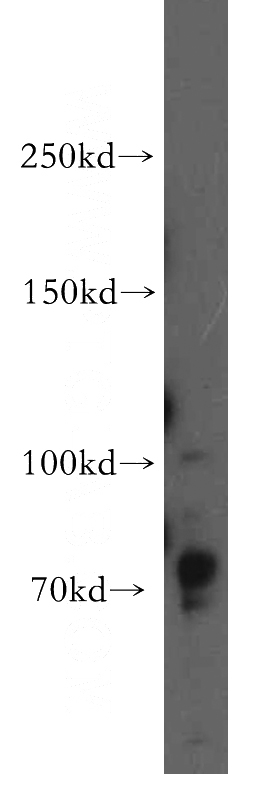 PC-3 cells were subjected to SDS PAGE followed by western blot with Catalog No:109992(DLG5 antibody) at dilution of 1:500