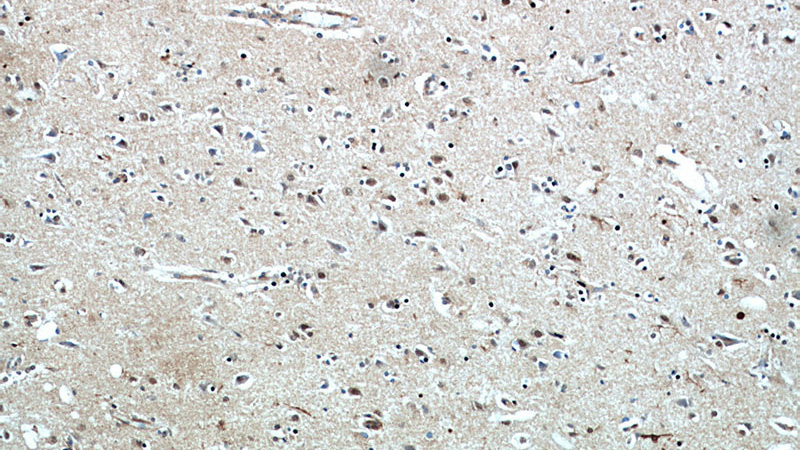 Immunohistochemical of paraffin-embedded human brain using Catalog No:113972(PLK5P antibody) at dilution of 1:50 (under 10x lens)