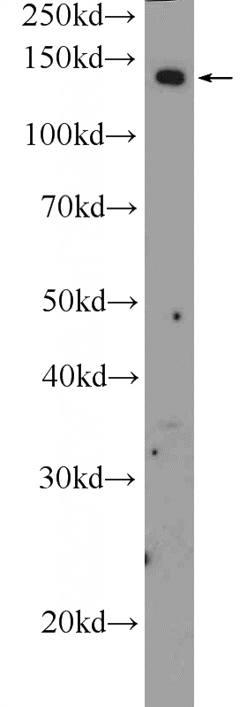 Neuro-2a cells were subjected to SDS PAGE followed by western blot with Catalog No:107782(ADCY8 Antibody) at dilution of 1:1000