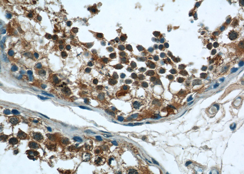 Immunohistochemistry of paraffin-embedded human testis tissue slide using Catalog No:114747(RNF17 Antibody) at dilution of 1:50 (under 40x lens)