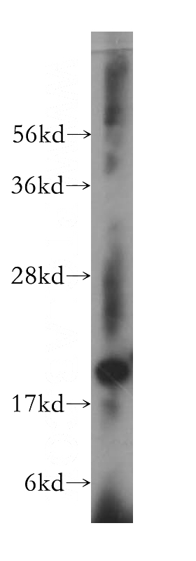 human brain tissue were subjected to SDS PAGE followed by western blot with Catalog No:113085(NDUFS7 antibody) at dilution of 1:500