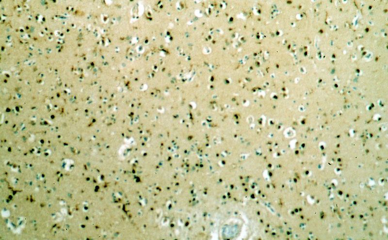 Immunohistochemical of paraffin-embedded human brain using Catalog No:117242(POU3F2-Specific antibody) at dilution of 1:100 (under 10x lens)