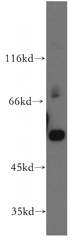 human placenta tissue were subjected to SDS PAGE followed by western blot with Catalog No:114402(QRSL1 antibody) at dilution of 1:300