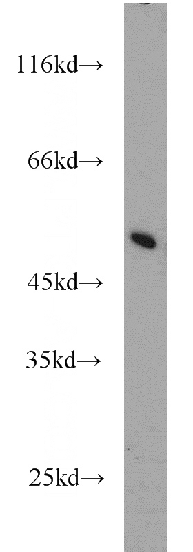 mouse liver tissue were subjected to SDS PAGE followed by western blot with Catalog No:112826(MRPL37 antibody) at dilution of 1:1000