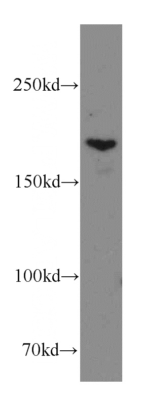 A549 cells were subjected to SDS PAGE followed by western blot with Catalog No:116036(THADA antibody) at dilution of 1:300