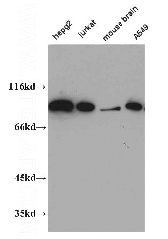 WB result of Catalog No:109224(CHFR antibody).