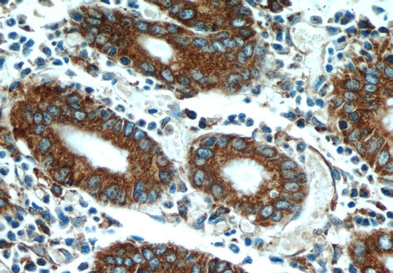 Immunohistochemical of paraffin-embedded human stomach using Catalog No:113682(PDIA6 antibody) at dilution of 1:50 (under 40x lens)