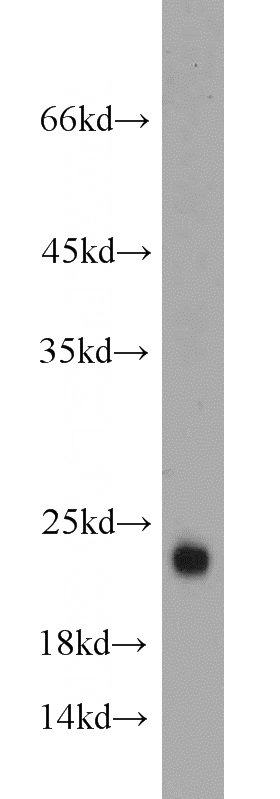 mouse brain tissue were subjected to SDS PAGE followed by western blot with Catalog No:111039(GLTP antibody) at dilution of 1:500
