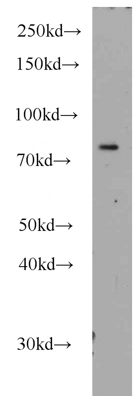 HeLa cells were subjected to SDS PAGE followed by western blot with Catalog No:113969(PLK2 antibody) at dilution of 1:1000
