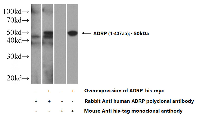 Transfected HEK-293 cells were subjected to SDS PAGE followed by western blot with Catalog No:107895(ADRP Antibody) at dilution of 1:2000