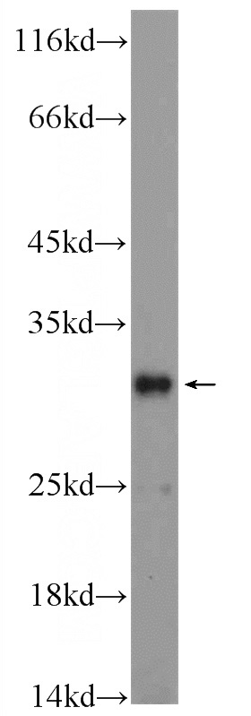mouse brain tissue were subjected to SDS PAGE followed by western blot with Catalog No:113832(CSDC2 Antibody) at dilution of 1:600