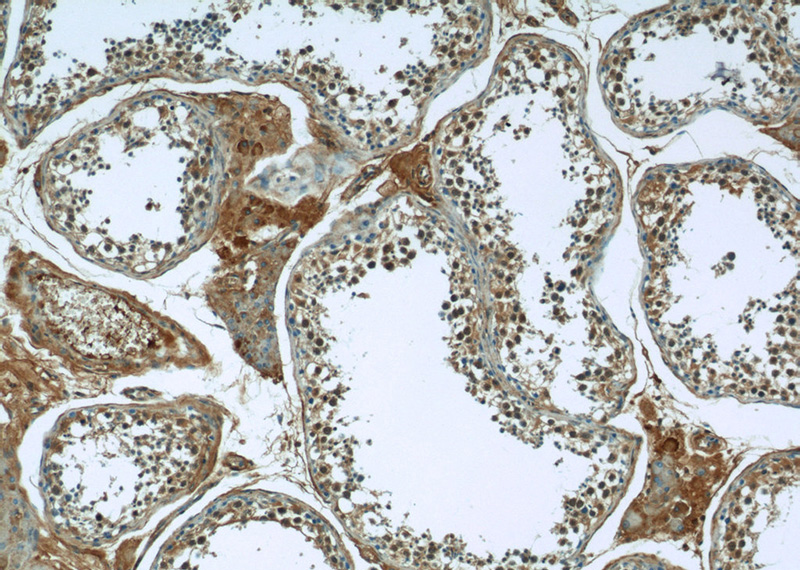 Immunohistochemistry of paraffin-embedded human testis tissue slide using Catalog No:108085(ANKS1B Antibody) at dilution of 1:50 (under 10x lens)