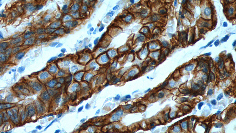 Immunohistochemistry of paraffin-embedded human stomach tissue slide using Catalog No:109338(CLDN18 Antibody) at dilution of 1:200 (under 40x lens).