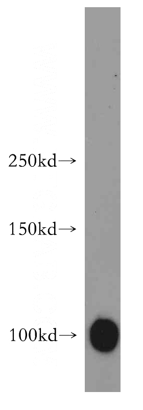 human skeletal muscle tissue were subjected to SDS PAGE followed by western blot with Catalog No:112425(MAP4K3 antibody) at dilution of 1:500
