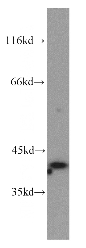 HeLa cells were subjected to SDS PAGE followed by western blot with Catalog No:113840(PITX1 antibody) at dilution of 1:800