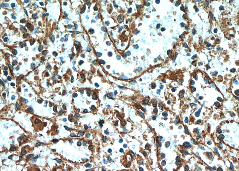 Immunohistochemical of paraffin-embedded human spleen using Catalog No:115708(STIM2 antibody) at dilution of 1:100 (under 40x lens)