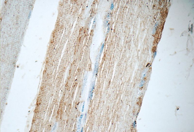 Immunohistochemistry of paraffin-embedded human skeletal muscle tissue slide using Catalog No:109277(CHRNA1 Antibody) at dilution of 1:50 (under 40x lens)
