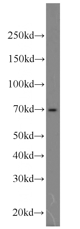 K-562 cells were subjected to SDS PAGE followed by western blot with Catalog No:114659(RHOBTB3 antibody) at dilution of 1:1000
