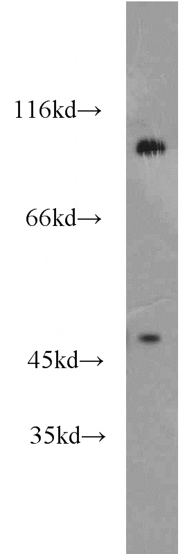 mouse brain tissue were subjected to SDS PAGE followed by western blot with Catalog No:114296(PSD2 antibody) at dilution of 1:1500