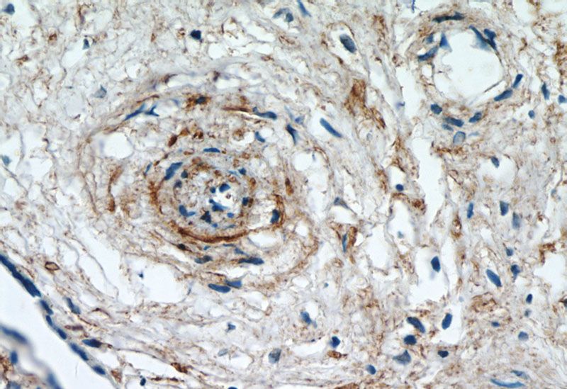 Immunohistochemistry of paraffin-embedded human placenta tissue slide using Catalog No:111922(KCNA10 Antibody) at dilution of 1:50 (under 40x lens)