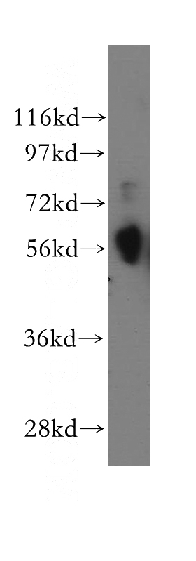 A549 cells were subjected to SDS PAGE followed by western blot with Catalog No:109547(CREB3L1,OASIS antibody) at dilution of 1:300