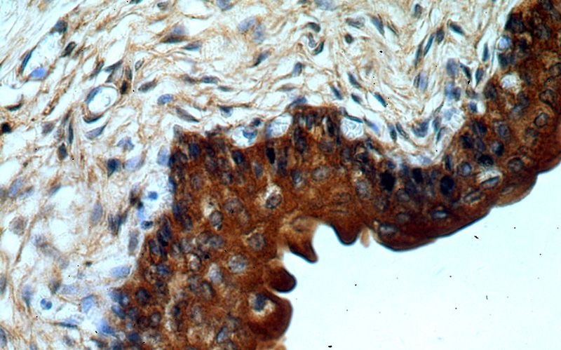 Immunohistochemical of paraffin-embedded human bladder using Catalog No:116017(TGDS antibody) at dilution of 1:50 (under 40x lens)