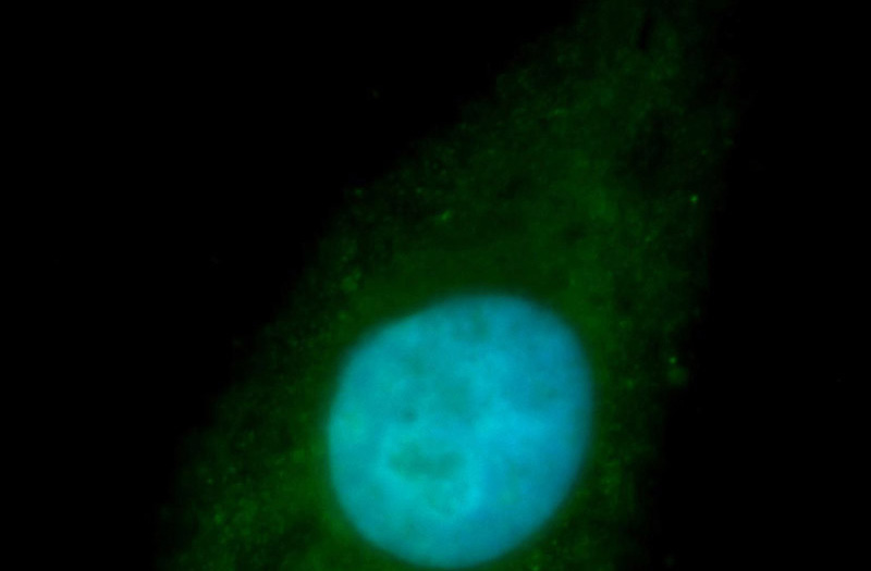 Immunofluorescent analysis of HepG2 cells, using RBM26 antibody Catalog No:114608 at 1:100 dilution and FITC-labeled donkey anti-rabbit IgG(green). Blue pseudocolor = DAPI (fluorescent DNA dye).
