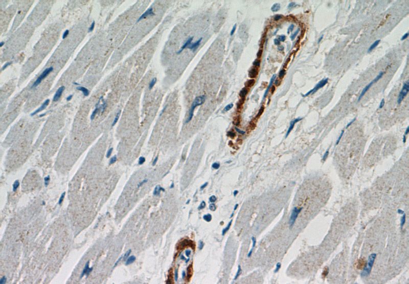 Immunohistochemical of paraffin-embedded human heart using Catalog No:108905(CNN1 antibody) at dilution of 1:50 (under 40x lens)