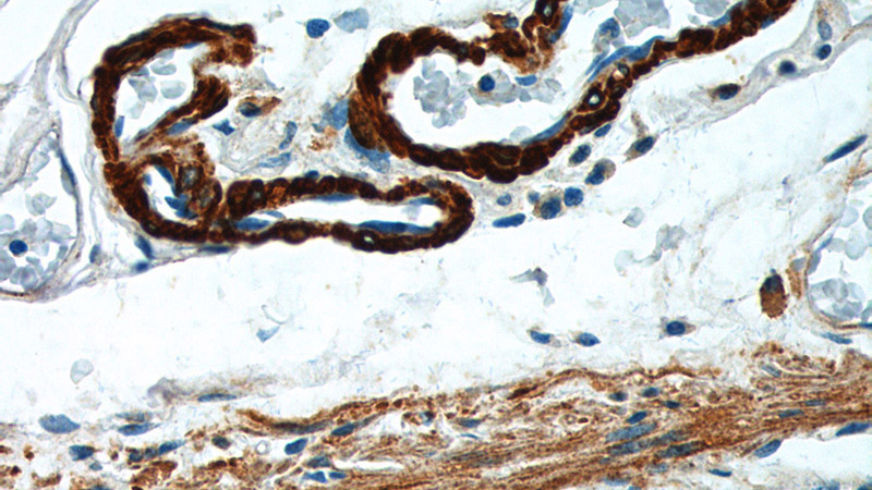 Immunohistochemistry of paraffin-embedded human colon tissue slide using Catalog No:115391(MYH11 Antibody) at dilution of 1:200 (under 40x lens).