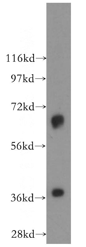 mouse heart tissue were subjected to SDS PAGE followed by western blot with Catalog No:112578(Mecr antibody) at dilution of 1:3000