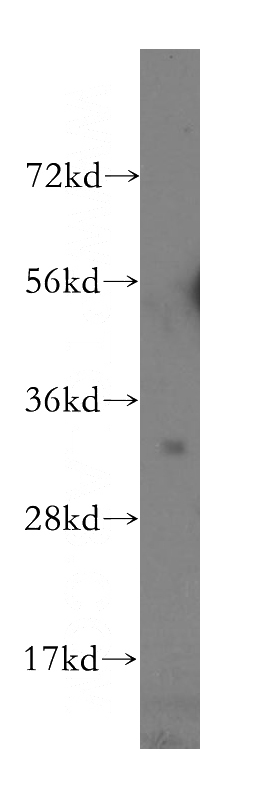 human ovary cancer were subjected to SDS PAGE followed by western blot with Catalog No:116446(TSPAN15 antibody) at dilution of 1:500