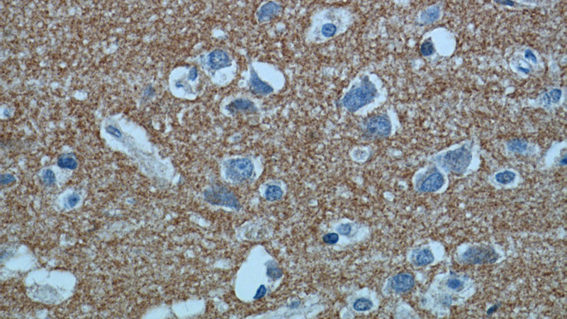Immunohistochemical of paraffin-embedded human brain using Catalog No:113274(NRCAM antibody) at dilution of 1:50 (under 40x lens)