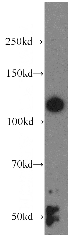 HEK-293 cells were subjected to SDS PAGE followed by western blot with Catalog No:107819(ABLIM1 antibody) at dilution of 1:1000