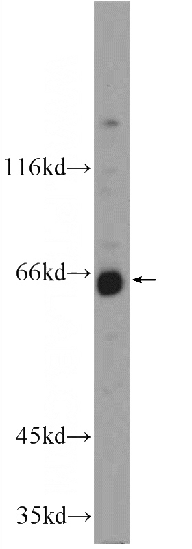 HeLa cells were subjected to SDS PAGE followed by western blot with Catalog No:116859(WDR20 Antibody) at dilution of 1:1000