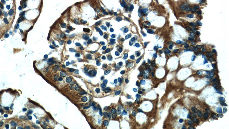 Immunohistochemistry of paraffin-embedded human small intestine tissue slide using Catalog No:112982(MYO1A Antibody) at dilution of 1:50 (under 40x lens)