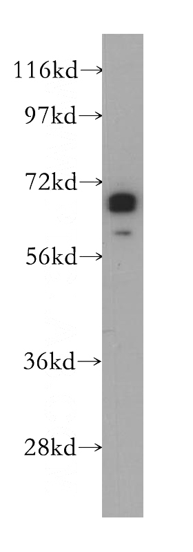 mouse brain tissue were subjected to SDS PAGE followed by western blot with Catalog No:117174(ZNF410 antibody) at dilution of 1:500