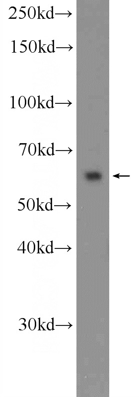 K-562 cells were subjected to SDS PAGE followed by western blot with Catalog No:112468(MANSC1 Antibody) at dilution of 1:600