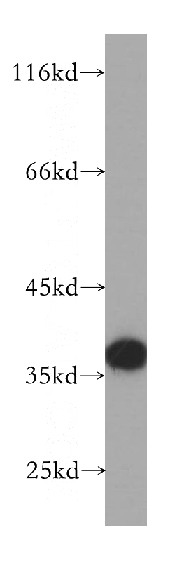 HeLa cells were subjected to SDS PAGE followed by western blot with Catalog No:112858(MRPS35 antibody) at dilution of 1:2000