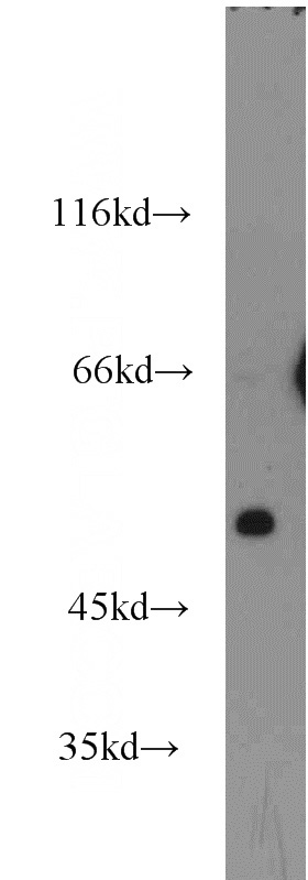 mouse pancreas tissue were subjected to SDS PAGE followed by western blot with Catalog No:115094(SCTR antibody) at dilution of 1:1500