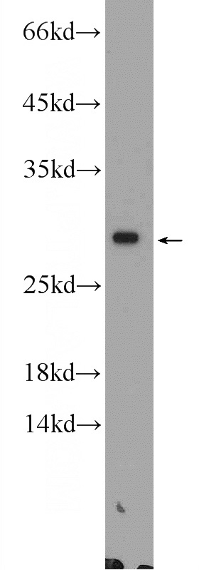 mouse ovary tissue were subjected to SDS PAGE followed by western blot with Catalog No:117050(ZGLP1 Antibody) at dilution of 1:300