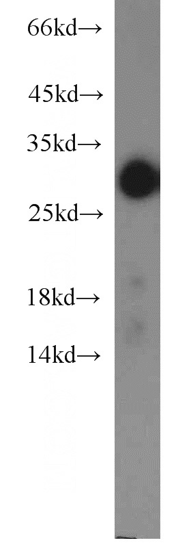 human adrenal gland tissue were subjected to SDS PAGE followed by western blot with Catalog No:115676(STAR antibody) at dilution of 1:500