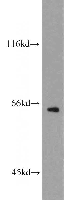 HepG2 cells were subjected to SDS PAGE followed by western blot with Catalog No:111056(GPAA1 antibody) at dilution of 1:400
