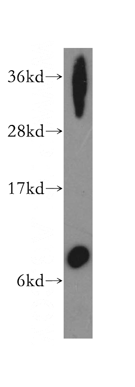 human stomach tissue were subjected to SDS PAGE followed by western blot with Catalog No:116354(TFF1 antibody) at dilution of 1:400