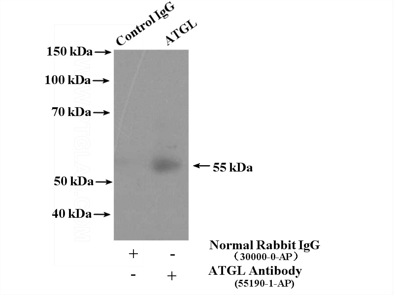IP Result of anti-ATGL (IP:Catalog No:108329, 4ug; Detection:Catalog No:108329 1:500) with mouse testis tissue lysate 4000ug.