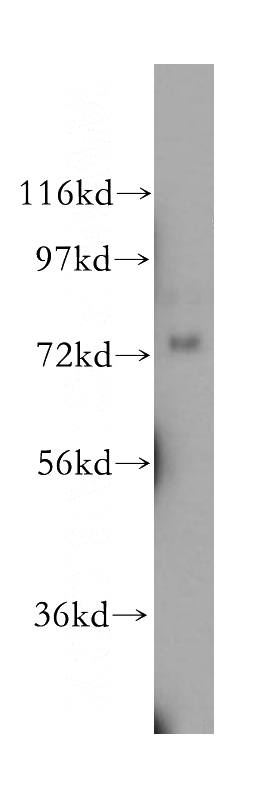 mouse ovary tissue were subjected to SDS PAGE followed by western blot with Catalog No:113240(NLN antibody) at dilution of 1:300