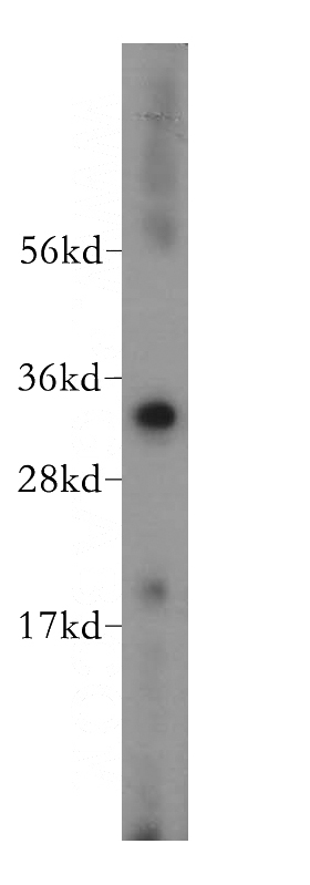 human heart tissue were subjected to SDS PAGE followed by western blot with Catalog No:116730(VDAC2 antibody) at dilution of 1:500