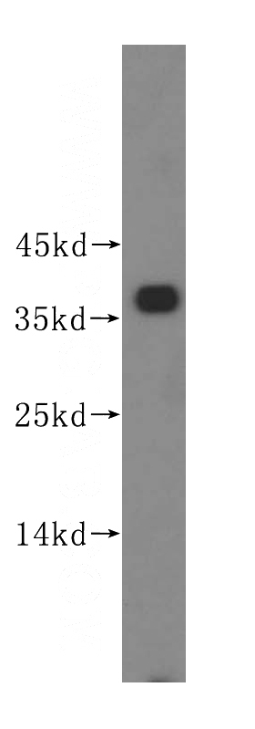 HeLa cells were subjected to SDS PAGE followed by western blot with Catalog No:113904(PIK3IP1 antibody) at dilution of 1:500